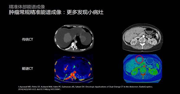 美国ge精准能谱ctrevolutionhd携手aw47震撼亮相投入使用